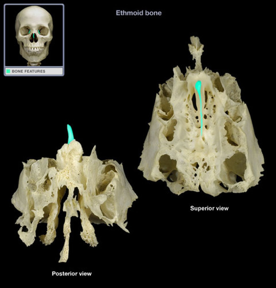 <p>superior projection in the middle of the cribriform plate of the ethmoid bone</p>