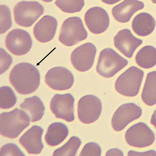 <p>What characteristic describes this erythrocyte?</p>