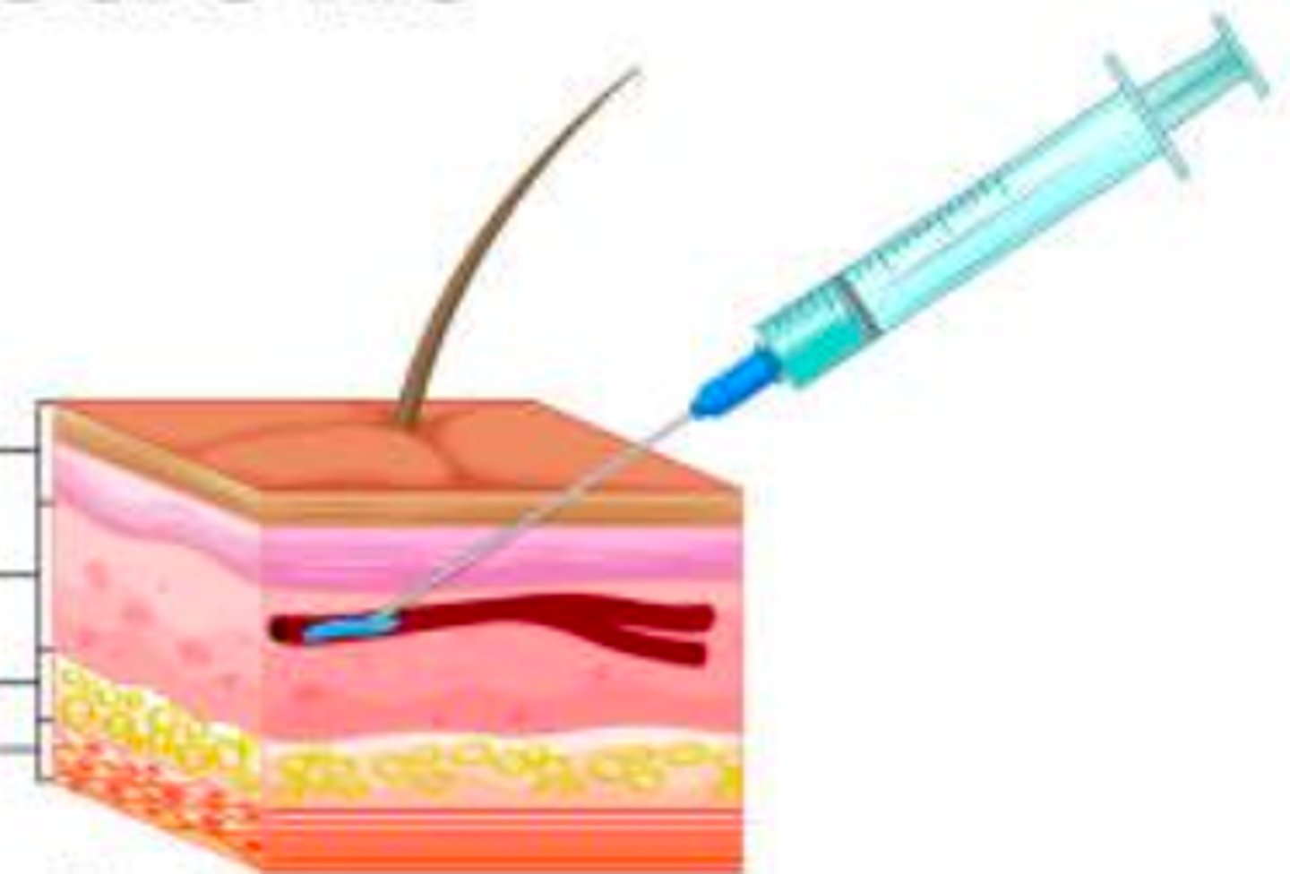 <p>Drug enters bloodstream directly providing 100% bioavailability and immediate effect.</p>