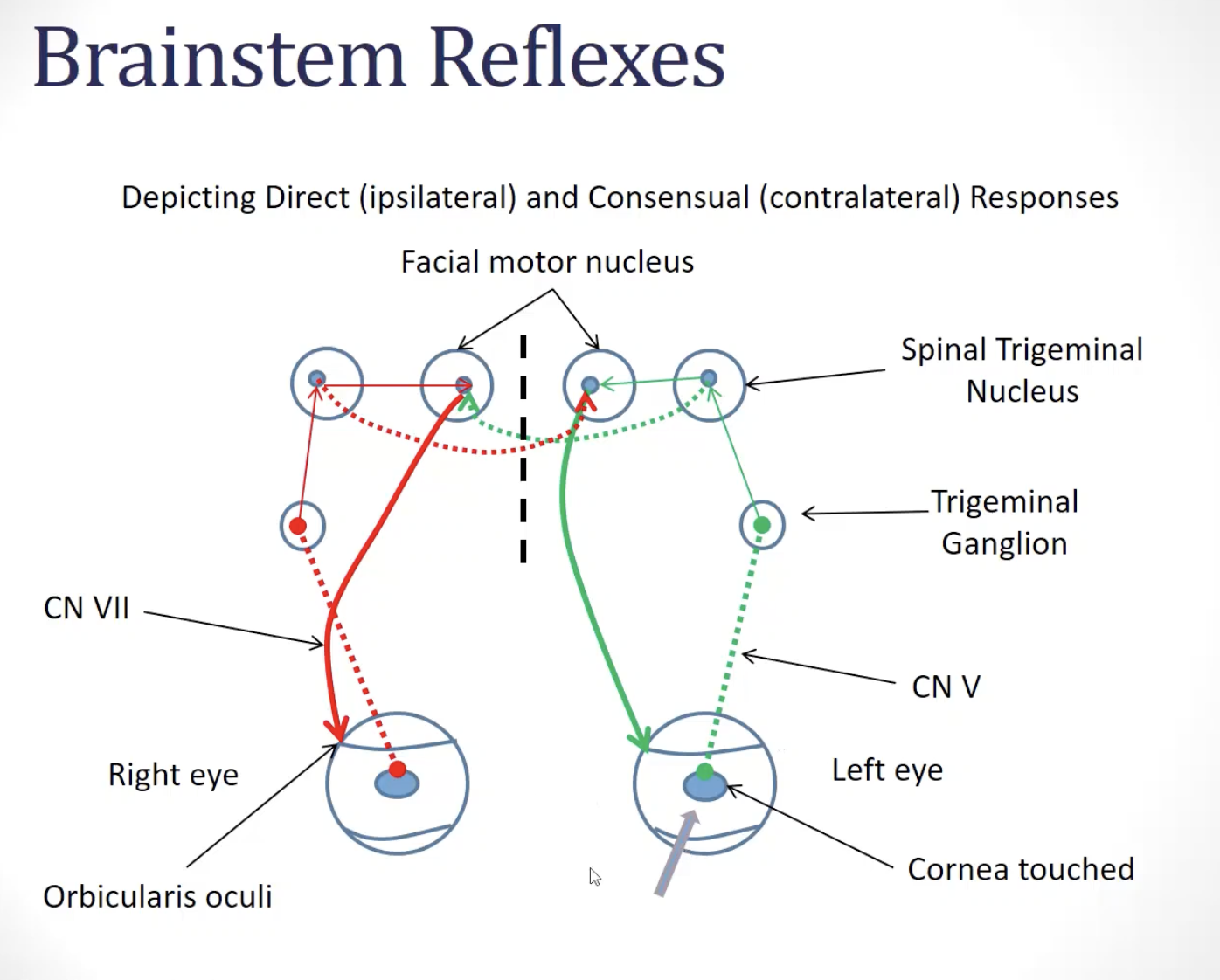 <ul><li><p><strong><u>***corneal reflex</u></strong>: (***<strong><u>CN V</u></strong> and <strong><u>CN VII</u></strong>)- <u>direct and consensual</u> (direct response occurs in the stimulated eye; consensual response occurs in the opposite eye)</p><ul><li><p><strong><u>circuit:</u></strong></p><ul><li><p><strong><em><u>***afferent limb:</u></em></strong> ***<strong><u>nociceptive fibers </u></strong>of the <strong><u>ophthalmic division of the </u><em><u>trigeminal nerve</u></em></strong><em> </em>project to the <strong><em><u>spinal trigeminal nucleus</u></em></strong> (pain)</p></li><li><p><strong><u>2nd order neurons of the </u><em><u>spinal trigeminal nucleus</u></em><u> project to the </u><em><u>facial motor nuclei</u></em></strong></p></li><li><p><strong><em><u>***efferent limb</u></em></strong><em><u>:</u> ***</em><strong><u>motor fibers</u></strong> from the <strong><em><u>facial motor nuclei </u></em><u>traveling in the</u><em><u> facial nerves</u></em><u> project to orbicularis oculi muscles</u></strong></p></li></ul></li></ul></li></ul><p><strong><u>***function</u></strong></p><ul><li><p><strong><u>designed to protect the eye</u></strong>; when <em>something enters the eye</em> and <em>scratches the cornea</em>, <strong><u>we blink in response to protect the cornea</u></strong></p></li><li><p><strong><u>eye that is stimulated will respond</u></strong>, but there <strong><u>also will be a consensual response; blink will happen in the contralateral eye as well</u></strong></p></li></ul><p><strong><u>image</u></strong></p><ul><li><p><strong><u>cornea is touched</u></strong></p></li><li><p><strong><u>activation of primary afferent;</u></strong> <strong><u>sensory/pain information travels</u></strong> in to <strong><u>reach the </u><em><u>spinal trigeminal nucleus</u> </em><u>(</u></strong><em>where pain information is processed</em><strong><u>)</u></strong></p></li><li><p>^ <strong><u>causes second order neuron in the </u><em><u>spinal trigeminal nerve</u></em><u> to become active</u></strong></p></li><li><p>^ this <strong><u>second order neuron will activate alpha motor neurons in the </u><em><u>facial motor nucleus</u></em><u> bilaterally</u></strong></p></li><li><p>—&gt; causes the <strong><u>orbicularis oculi to become activated</u></strong></p></li><li><p>—&gt; causes <strong><u>eye blinks</u></strong></p></li><li><p>—&gt; <strong><u>feedforward excitation across to the </u><em><u>facial motor nucleus on the contralateral side of the pons</u></em><u> also causes activation of orbicularis oculi on the other side</u></strong></p></li><li><p>showcases…</p><ul><li><p><strong><u>afferent limb is intact on one side</u></strong></p></li><li><p><strong><u>efferent limb is intact on ^ same side</u></strong></p></li><li><p><strong><u>efferent limb is intact on opposite side</u></strong></p></li></ul></li></ul><p></p>