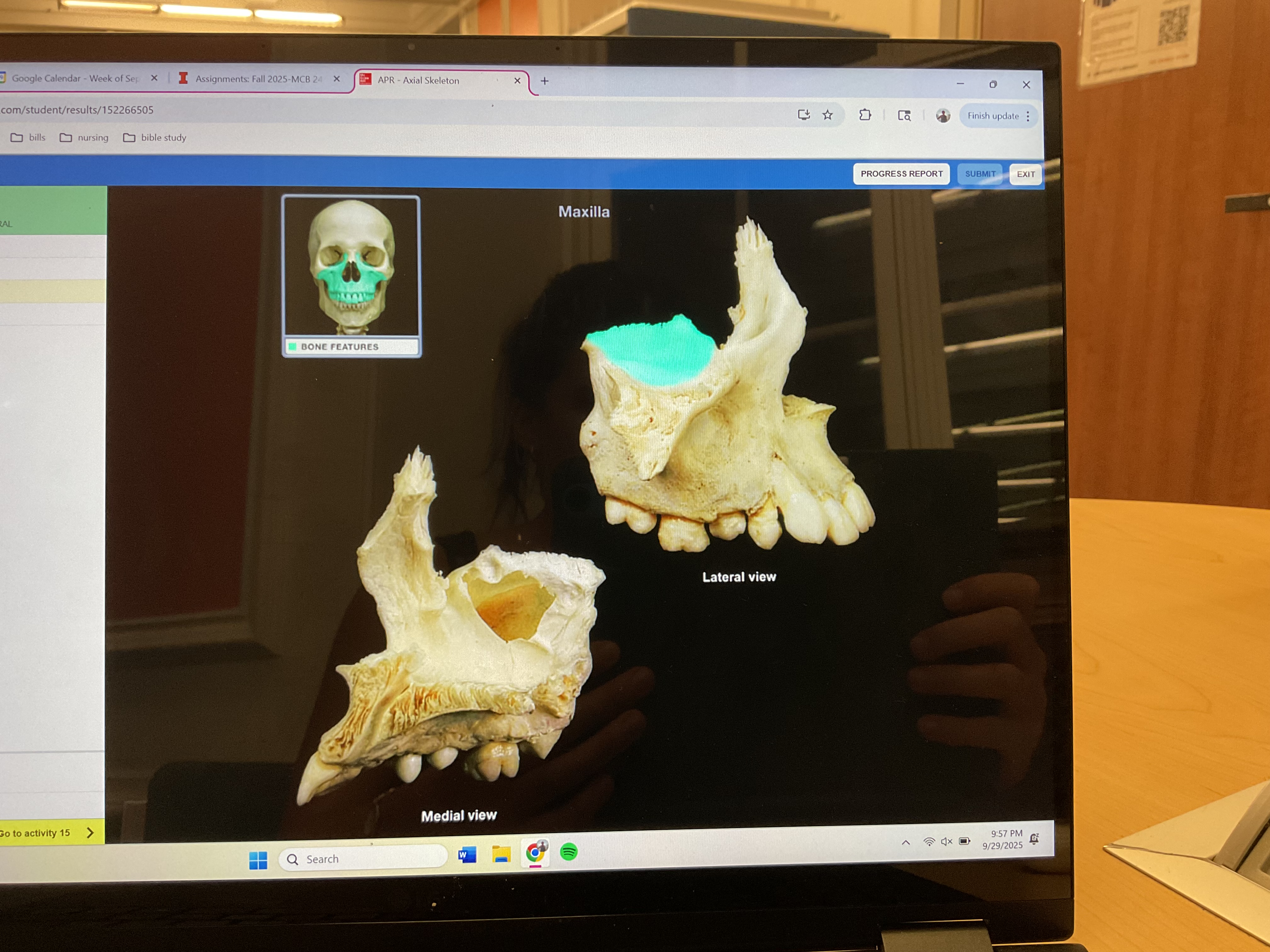 <p>Orbital surface of maxilla </p>