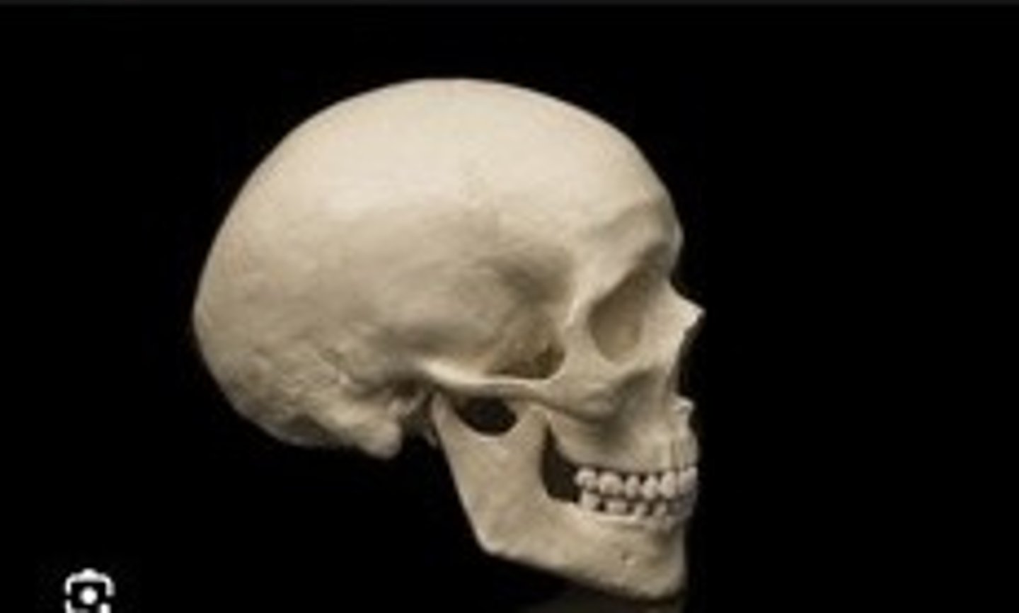 <p>The skull that encases the brain.</p>