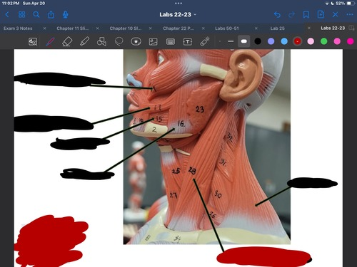 <p>What muscle is this?</p>