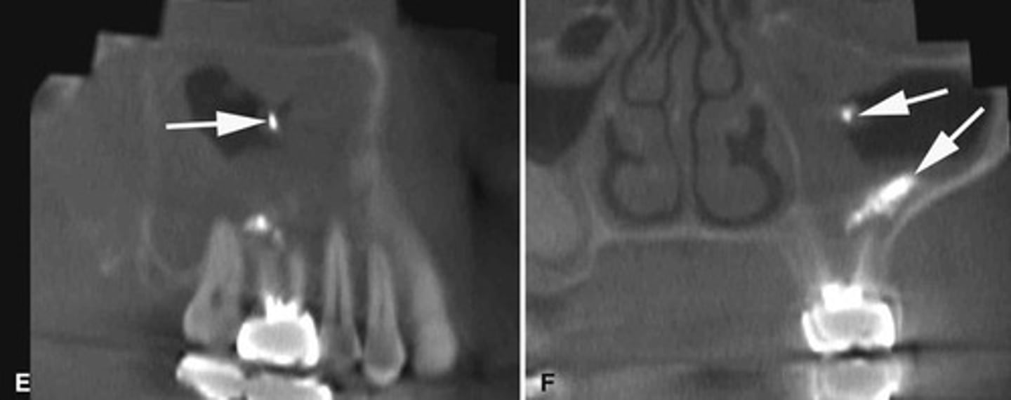 <p>What does the image show?</p>