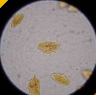 <p>symptoms of&nbsp;<span style="color: rgb(254, 250, 250);"><span>Tritrichomonas spp in cattle&nbsp;</span></span></p>