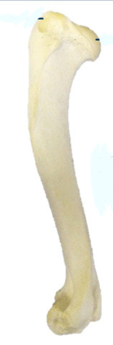 <p>What bone is this?</p>