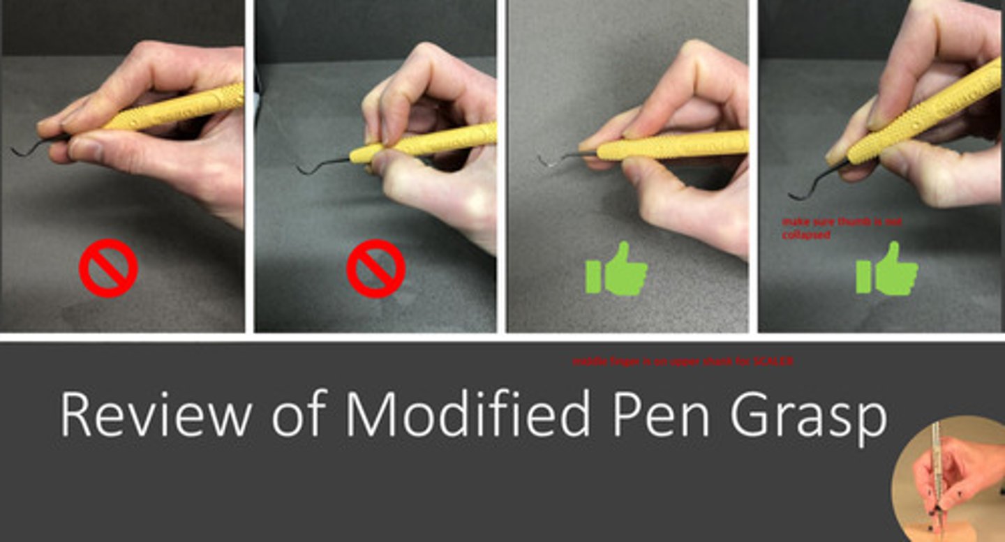 <p>1) index finger and thumb are on opposite sides of the instrument</p><p>2) thumb is not collapsed</p><p>3) middle finger is on the upper shank for the SCALER (note that it is on the lower shank for an explorer or perio probe)</p>