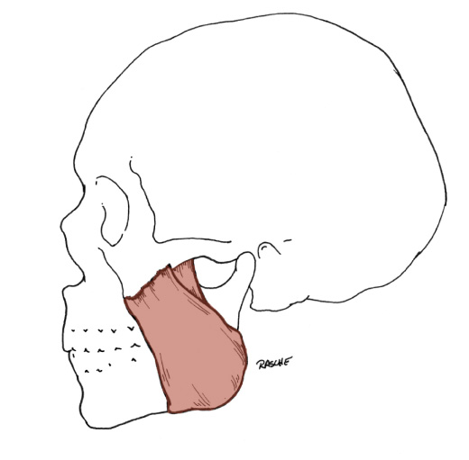 <p>Origin: Zygomatic arch and Zygomatic bone</p><p>Insertion: Lateral surface of the ramus and angle of the Mandible</p><p>Action: Elevates the Mandible</p>