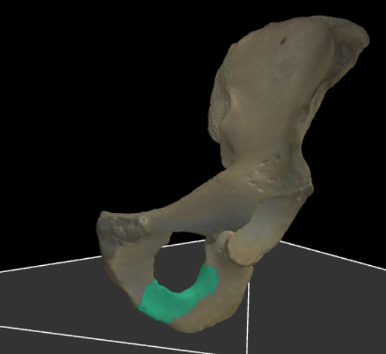<p>De beenbalk van het ischium die naar voren uitsteekt en samenkomt met de ramus inferior ossis pubis.</p>
