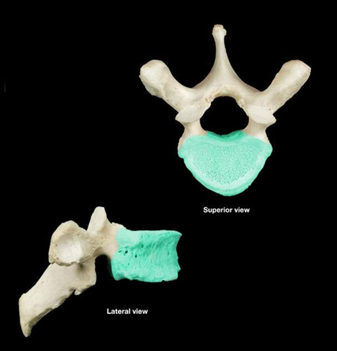 <p>Larger than cervical; heart shaped; bears costal facets</p>