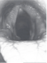 <p>Dixon Grade?</p>