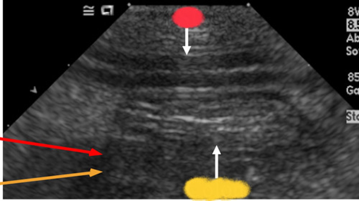 <p>ID which is the small intestine and which is the colon</p>