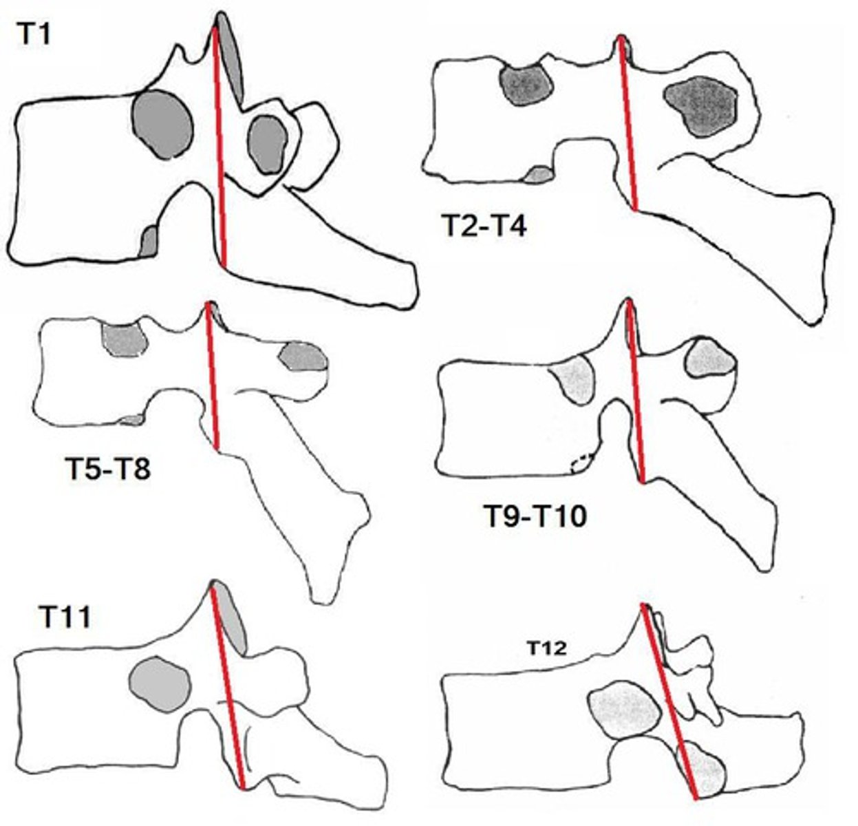 <p>Only present on T11 &amp; T12, gray circle</p>