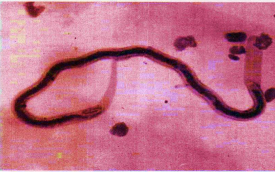 <p>Parasite under microscope</p>