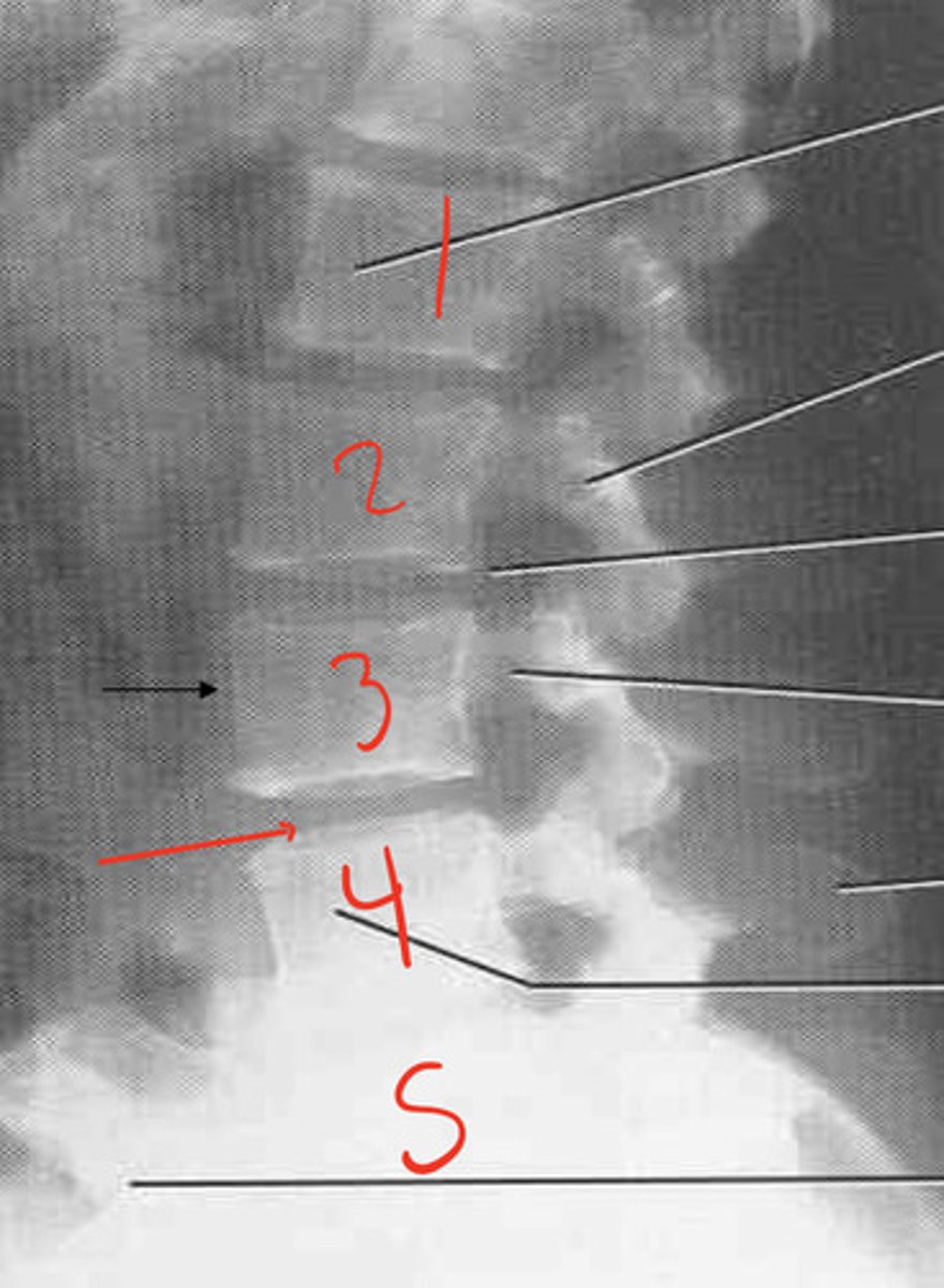 <p>what is this image?</p><p>what is the black arrow pointing to?</p><p>what is the space below the black arrow?</p>