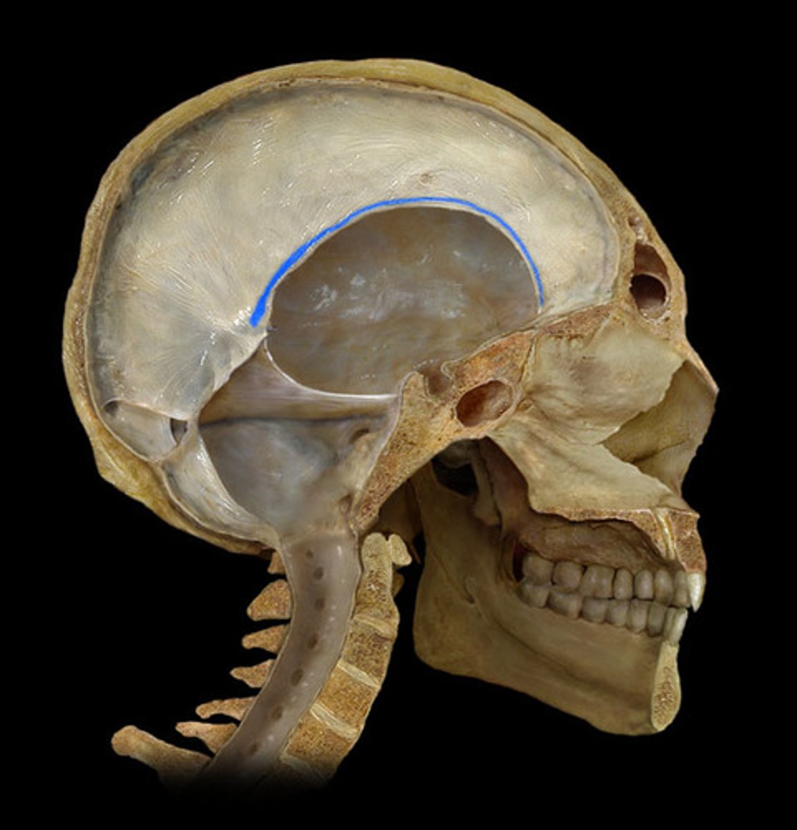 <p>lower border of falx cerebri</p>