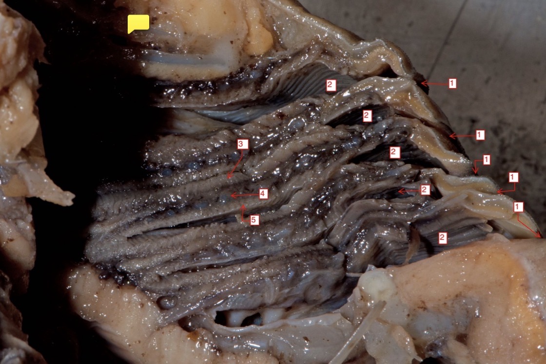 <p>frontal section of gill arches- (4)</p>