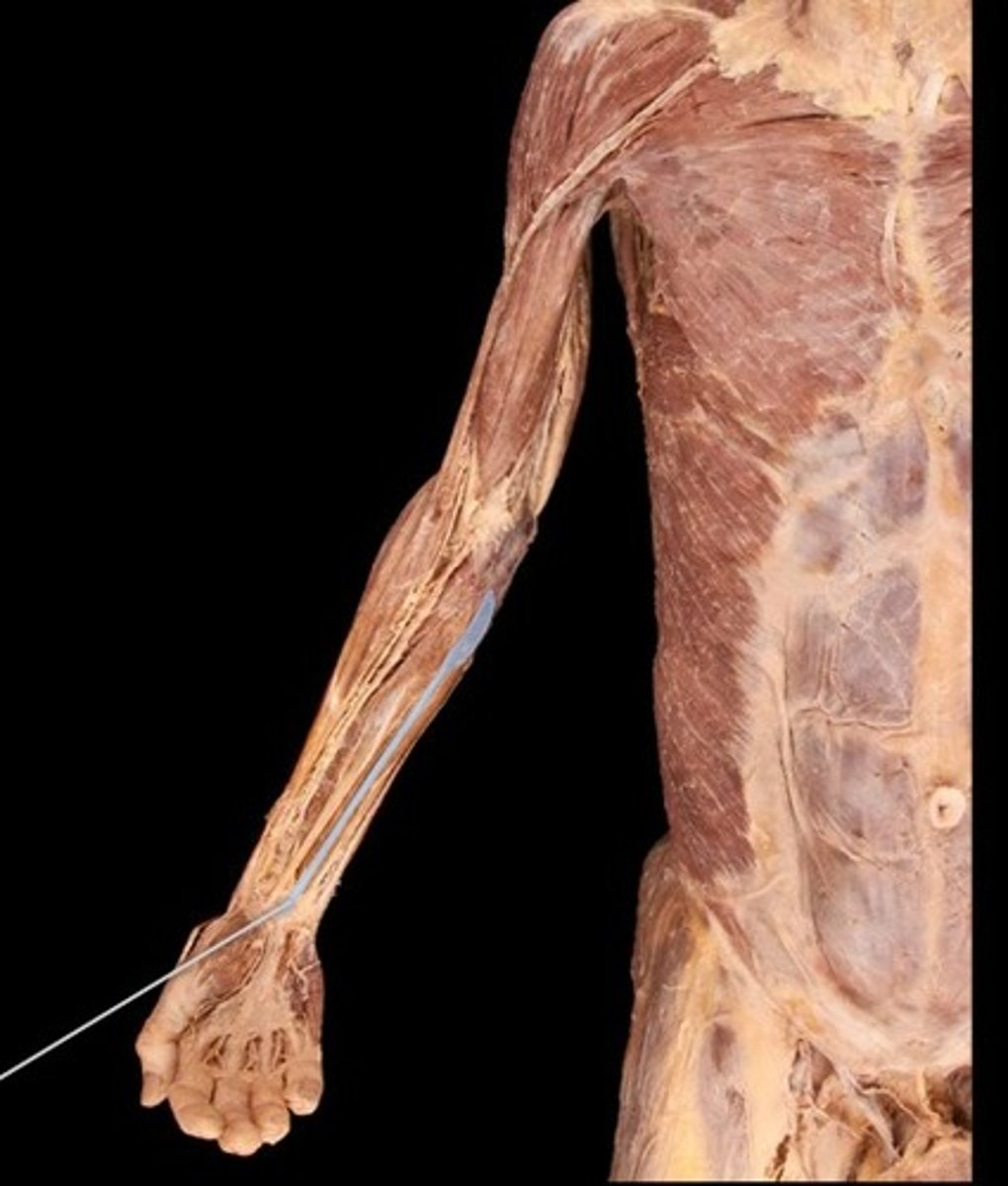 <p>What muscle is this?</p>