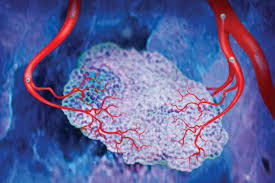 <p>Formation of new blood vessels from<strong> pre-existing</strong> vasculature.</p>