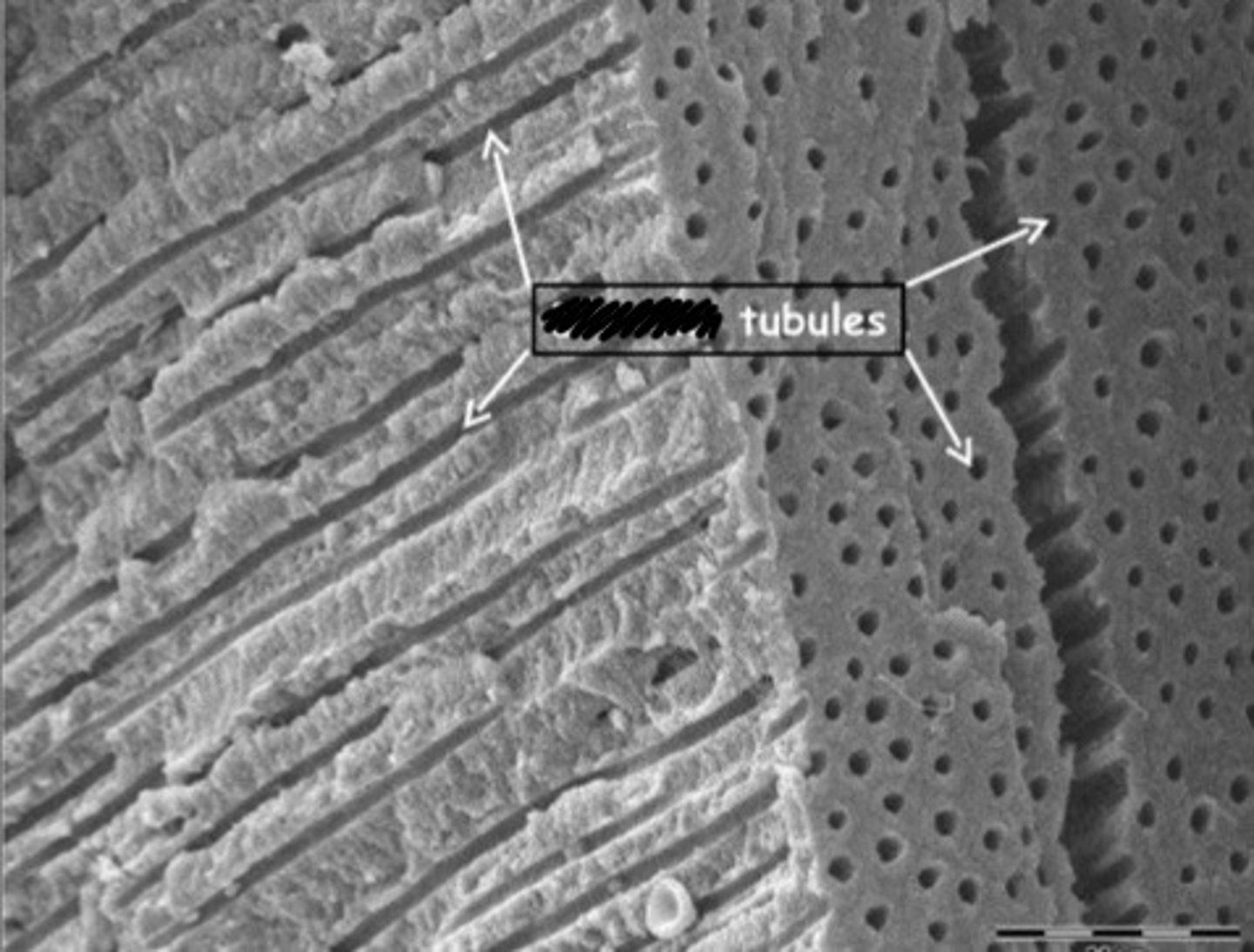 <p>What structure makes up the bulk of the tooth? It is made up of a bunch of tiny tubules. If these tubules are exposed, the tooth is sensitive and can become contaminated. It is made up mostly of mineral and is produced throughout the life of the tooth.</p>