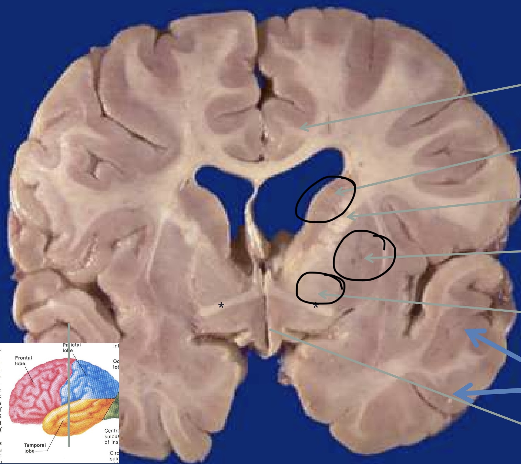 <p>Que sont les noyaux gris ?</p>