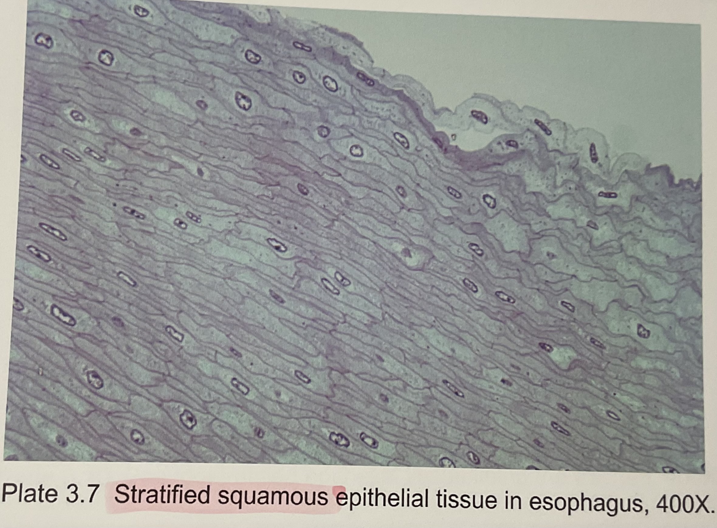 <p>Stratified squamous non-keratinize</p>