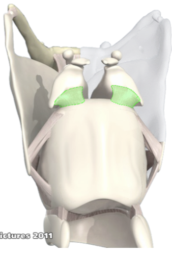 <p>What ligament is this?</p>