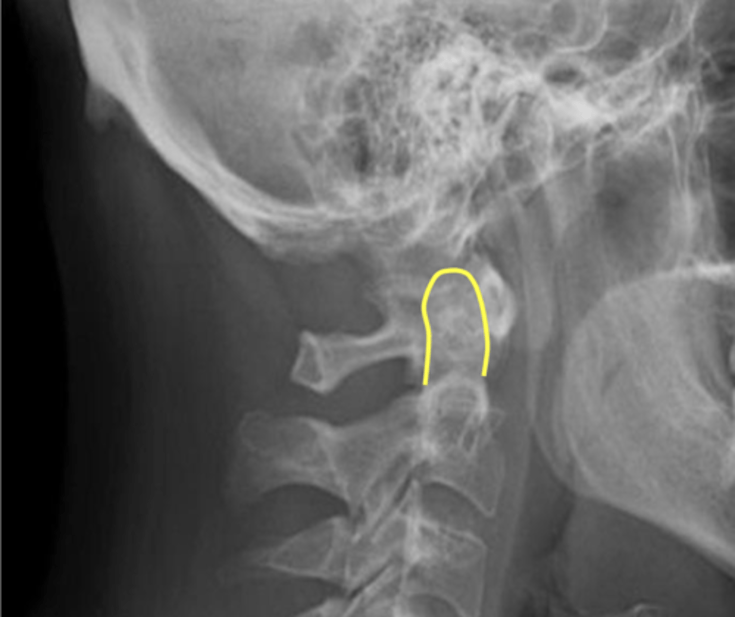 <p>What is the yellow line?</p>