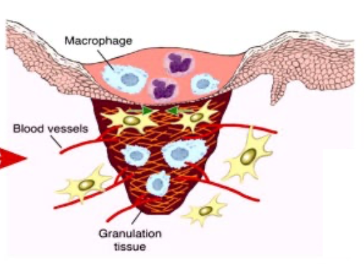 <p>fibroplasia</p><ul><li><p>necessary for other processes</p></li></ul><p>angiogenesis</p><p>epithelialization </p><p></p>