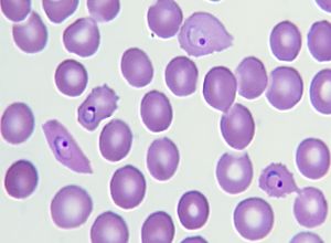 early trophozoite plasmodium ovale
