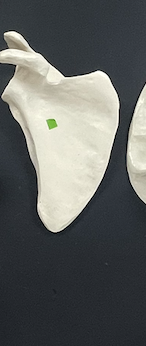 <p>Name this bone?</p>