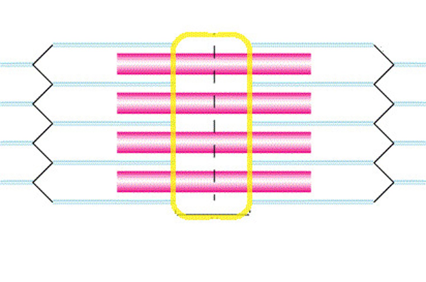 <p>The region at the center of an A band of a sarcomere that is made up of myosin only; this zone gets shorter and may disappear during muscle contraction.</p>