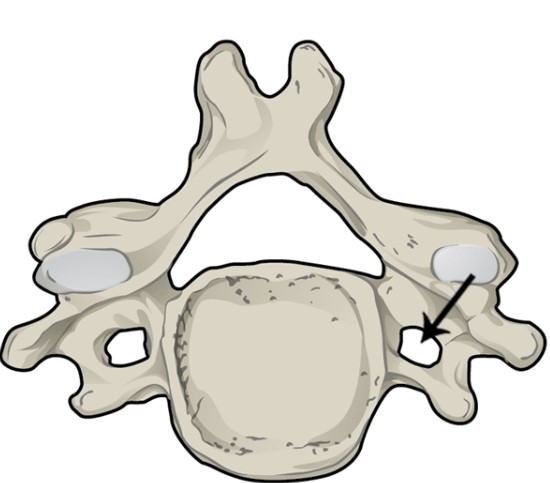 <p>What structure of the vertebra is this? </p>