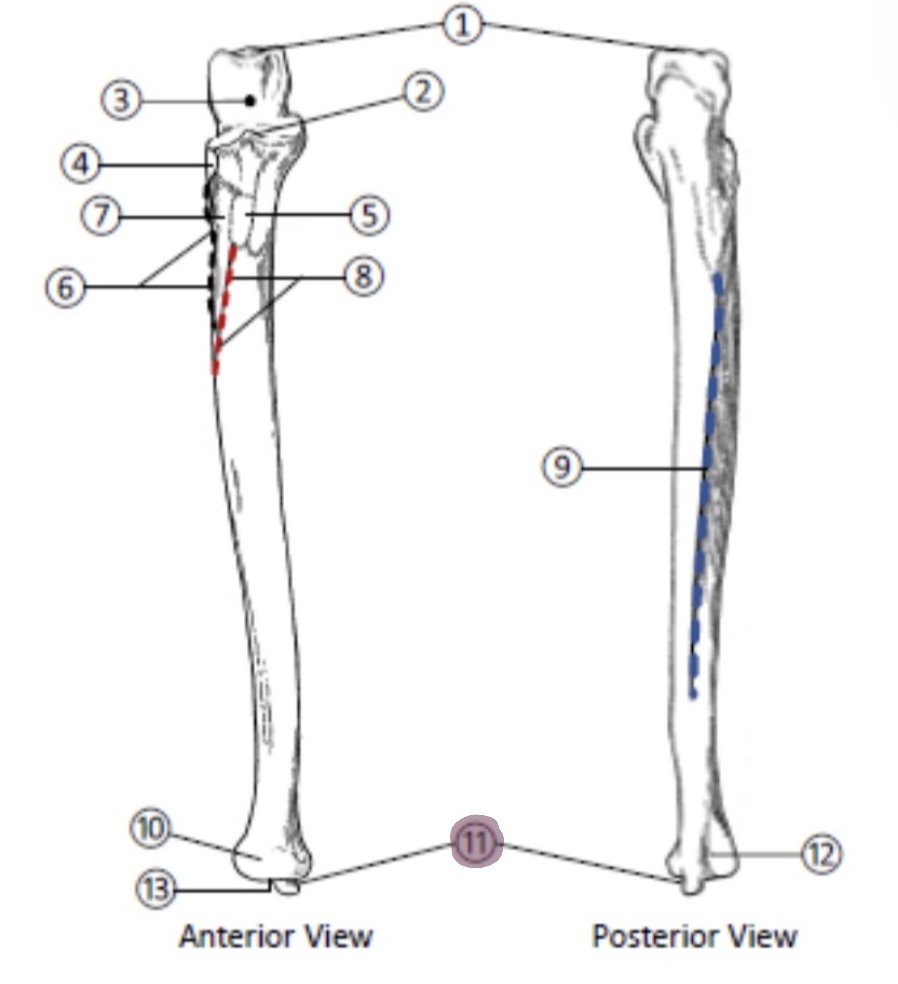 <p>On the Distal end of the Ulna, which part is highlighted (11)?</p>