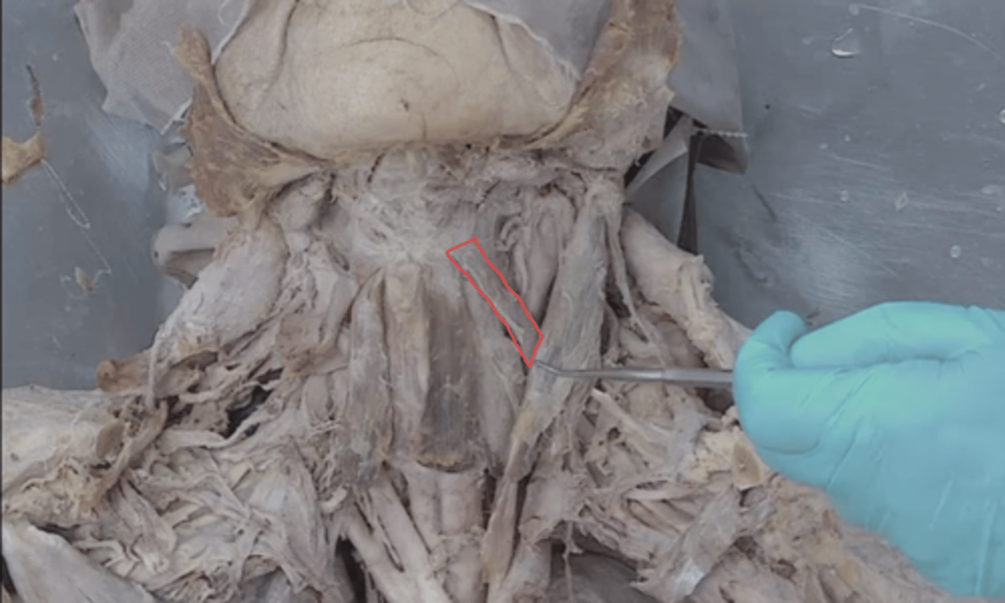 <p>identify this muscle</p>