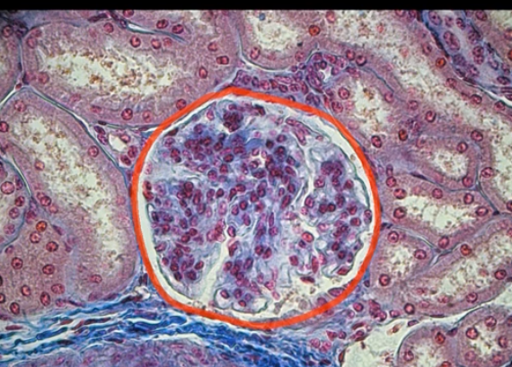 <p>the parietal layer consists of [ ] epithelium that surrounds the glomerulus </p>
