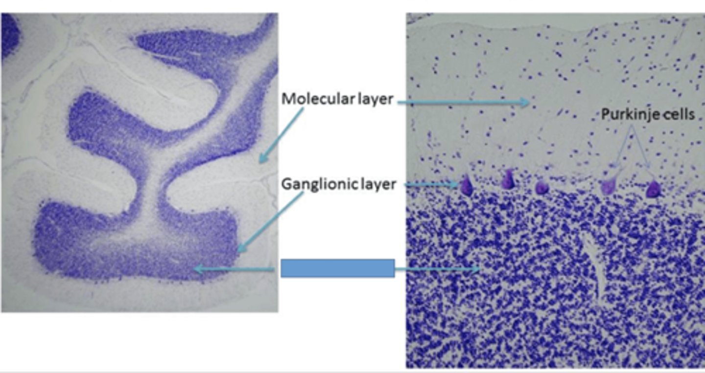<p>Identify the layer of the cerebellum</p>