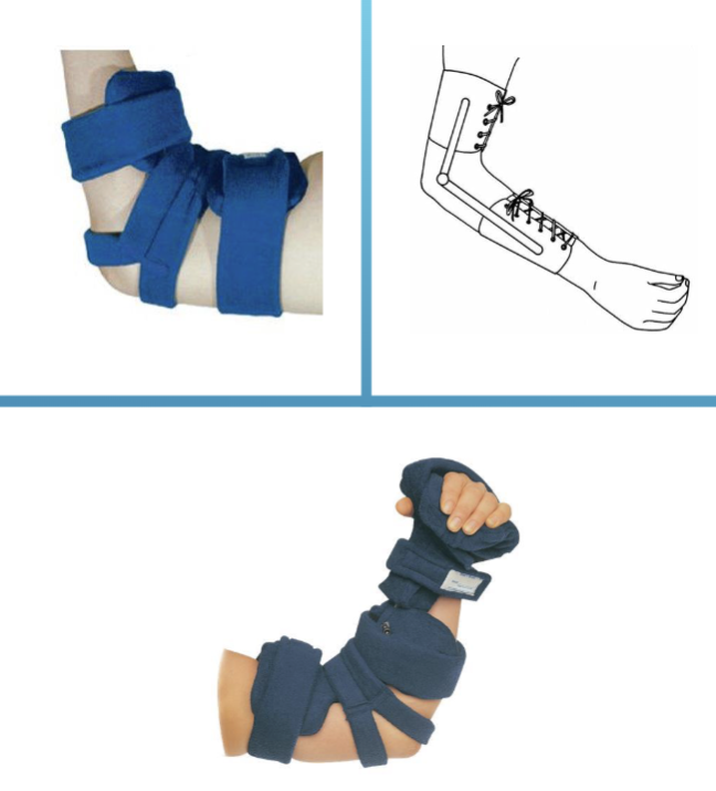 <p>Elbow Orthoses </p>