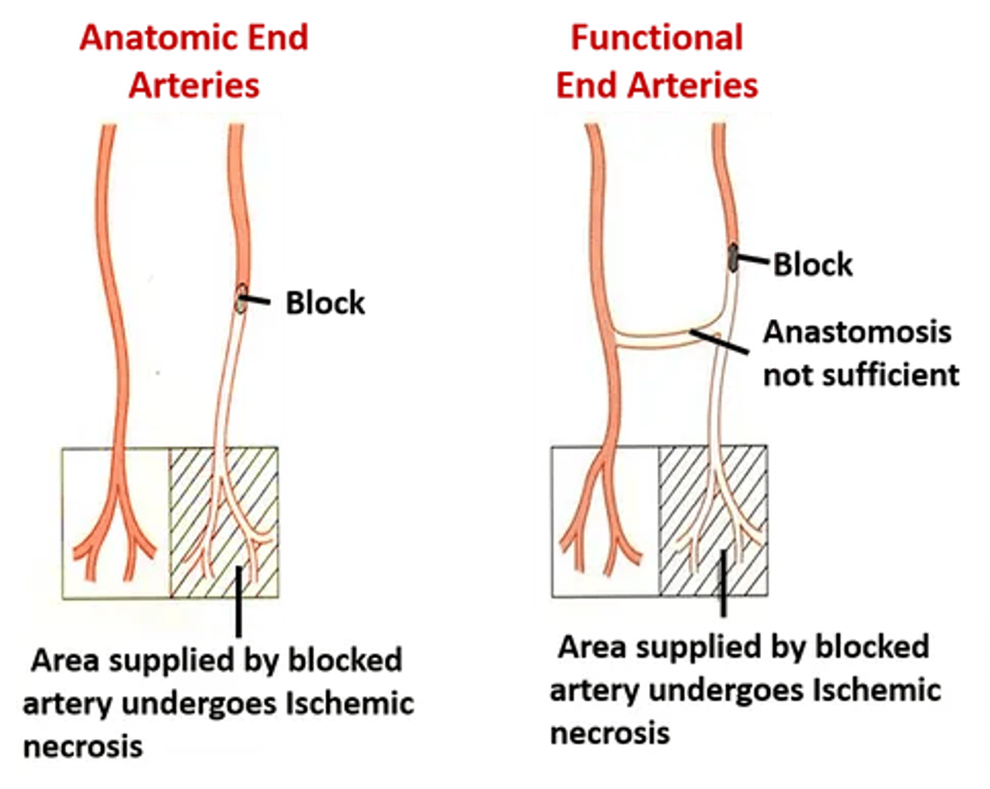 <p>functional end arteries</p><p>The 3 cerebral arteries supplying the forebrain have limited anastomoses (potential) between each other</p>