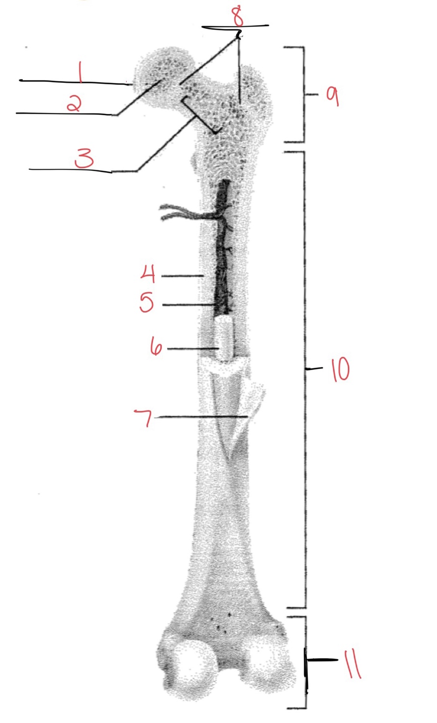 <p>Compact bone</p>