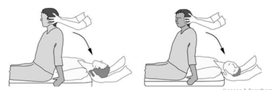 <ul><li><p>Assessment for Anterior and Posterior Canal BPPV</p></li><li><p><em>Warn patient of possible symptom reproduction, nausea, sickness, and that there is a vomit bag nearby if needed*</em></p></li></ul><ol><li><p>Instruct patient where you’re going to grip them and what movement is going to be done.</p></li><li><p>Rotate head 45deg to <strong>affected </strong>side</p></li><li><p>Patient’s gaze fixed to examiners nose or recommended target</p></li><li><p>Lie down patient swiftly, placing head into 30deg extension and off the bed</p></li><li><p>Observe for nystagmus and other symptoms</p></li></ol><p></p><p><u>Interpretation</u>:</p><p>Posterior canal → Affected rotational and up beating</p><p>Anterior canal → Affected rotational and down beating</p><p></p>