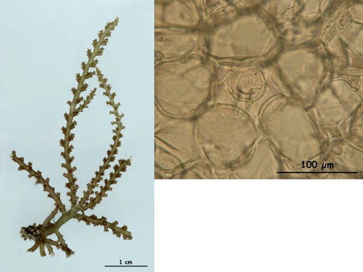 <p>To which Genus does this specimen belong?</p><p>Acanthophora</p><p>Digenea</p><p>Chondria</p><p>Laurencia</p>