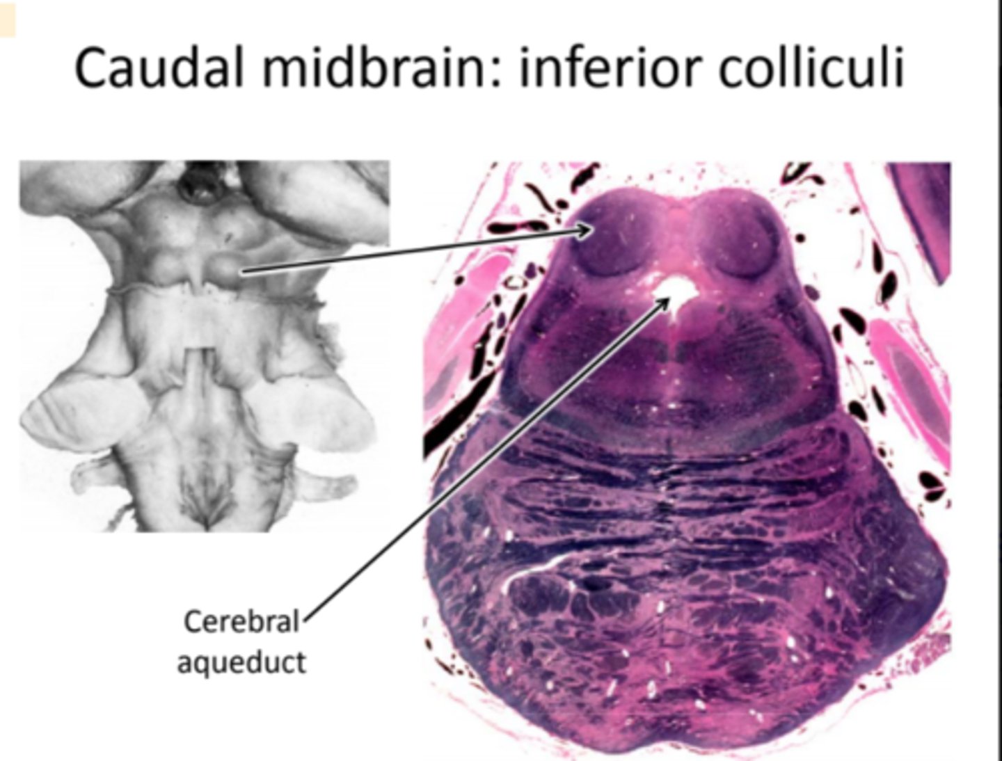 <p>Inferior colliculus has appeared: auditory processing.<br>- Colliculus: Latin for "small hill"<br>- There are two pairs of bumps on the dorsal midbrain: the inferior colliculi and the superior colliculi.</p>