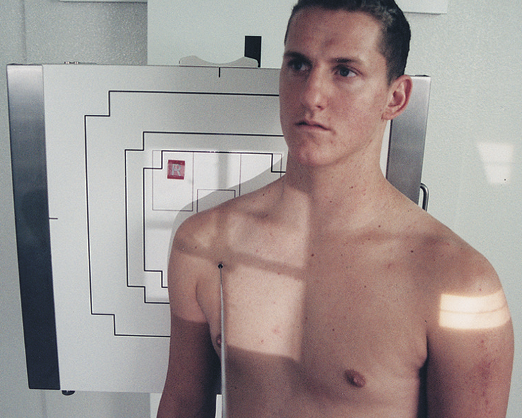 <p>Grashey method&nbsp;</p><ul><li><p>AP oblique&nbsp;</p></li><li><p>patient 35-45° toward affected side&nbsp;</p></li><li><p><span><span>CR 2” inferior and medial from superlateral border of humerus</span></span></p></li></ul><p></p>