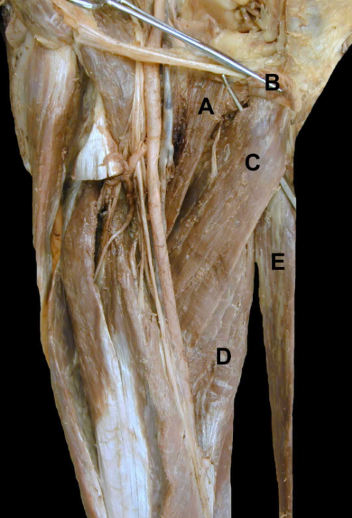 <p>E</p>