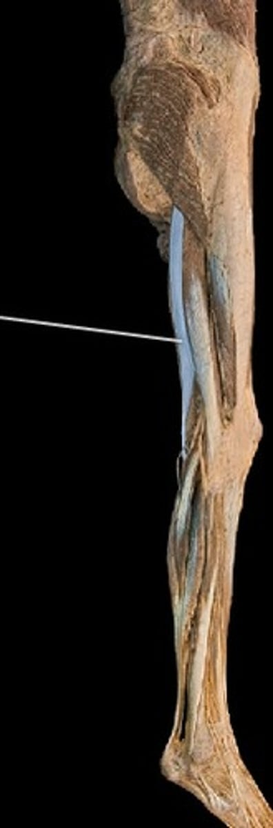 <p>What muscle is this?</p>