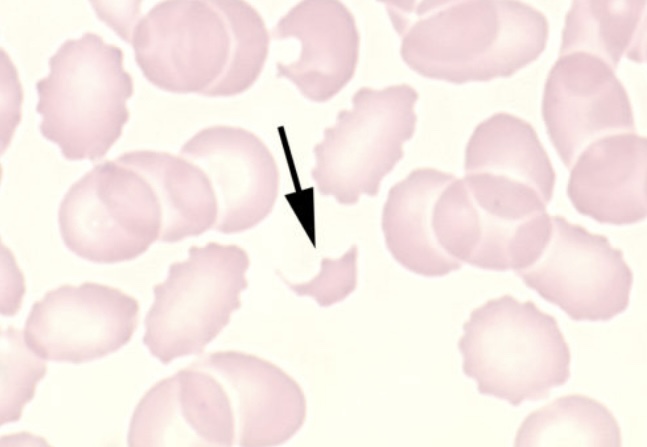 term image