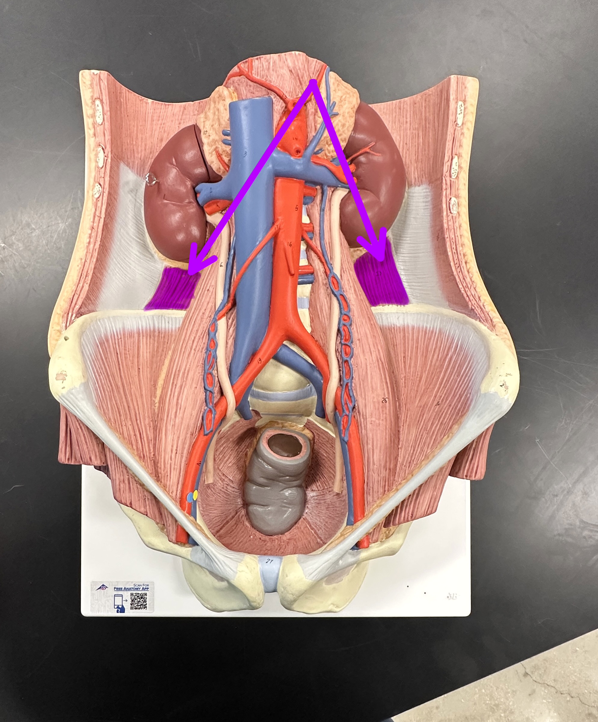 <p>What is the highlighted structure</p>