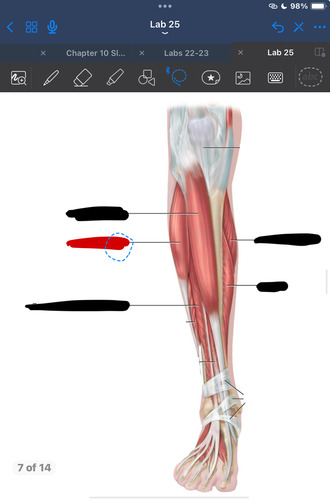 <p>What muscle is this?</p>