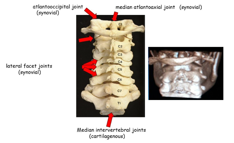 <p>median atlantoaxial joint </p><p>median intervertebral joints </p><p>lateral facet joints </p><p>atlantooccipital joint</p>